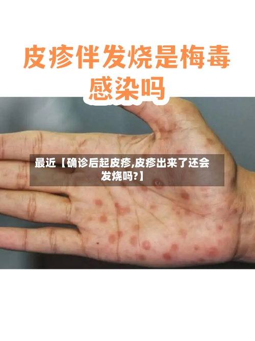 最近【确诊后起皮疹,皮疹出来了还会发烧吗?】